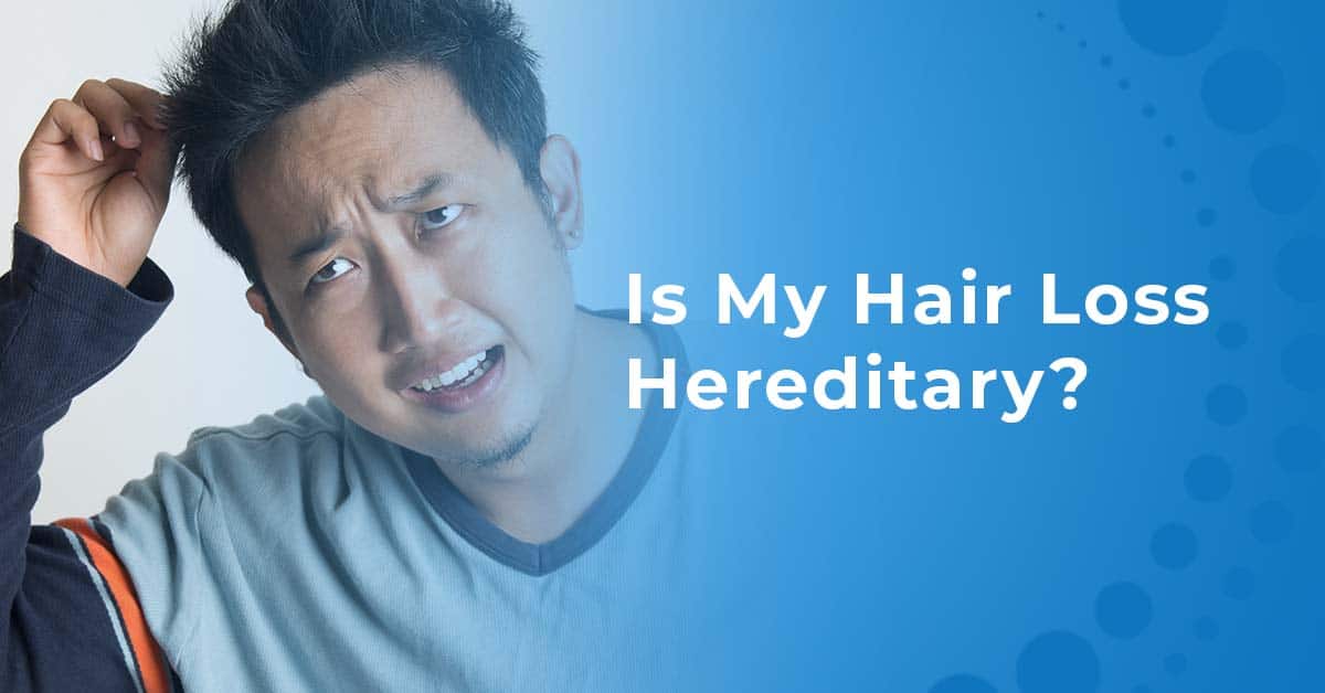 hereditary hair loss