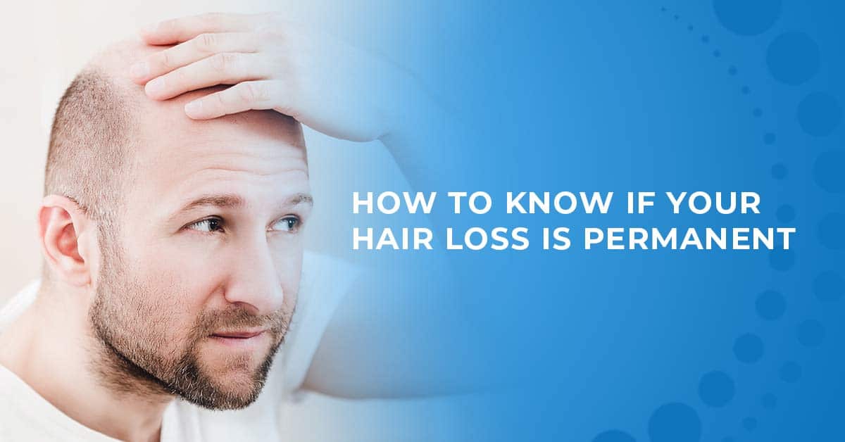 permanent hair loss