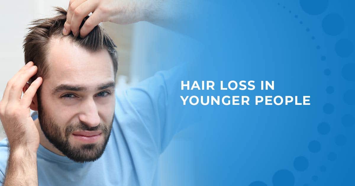 Hair loss in younger people
