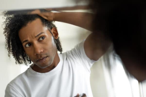 hair loss by ethnicity 
