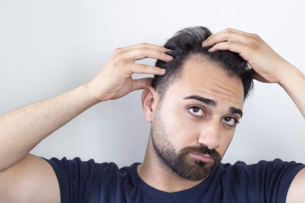 hair loss from stress